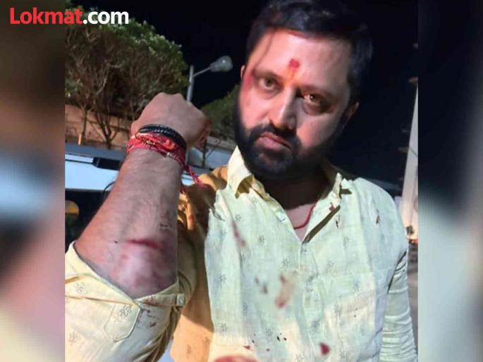 Maharashtra assembly vidhan sabha election 2024 Jansurajya Party candidate Santaji Ghorpade fatally attacked in Karveer Constituency | Kolhapur: करवीर मतदारसंघातील जनसुराज्य पक्षाचे उमेदवार संताजी घोरपडे यांच्यावर जीवघेणा हल्ला Maharashtra assembly vidhan sabha election 2024 Jansurajya Party candidate Santaji Ghorpade fatally attacked in Karveer Constituency | Kolhapur: करवीर मतदारसंघातील जनसुराज्य पक्षाचे उमेदवार संताजी घोरपडे यांच्यावर जीवघेणा हल्ला