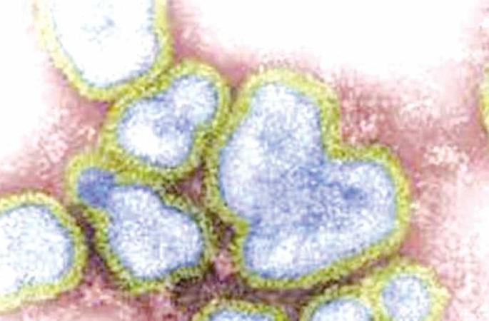 Corona Virus in Nagpur: Two Sari patients die in Nagpur | CoronaVirus in Nagpur : नागपुरात सारीच्या दोन रुग्णाचा मृत्यू