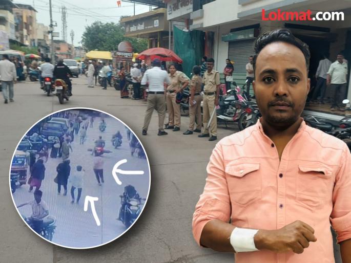 firing in shirwal satara and one youth injured | शिरवळ येथे गोळीबार, एक युवक जखमी firing in shirwal satara and one youth injured | शिरवळ येथे गोळीबार, एक युवक जखमी