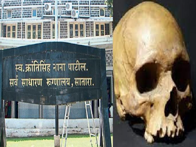 Human skull found in the premises of Satara District Hospital | जिल्हा रुग्णालयाच्या आवारात आढळली मानवी कवटी, उडाली एकच खळबळ 