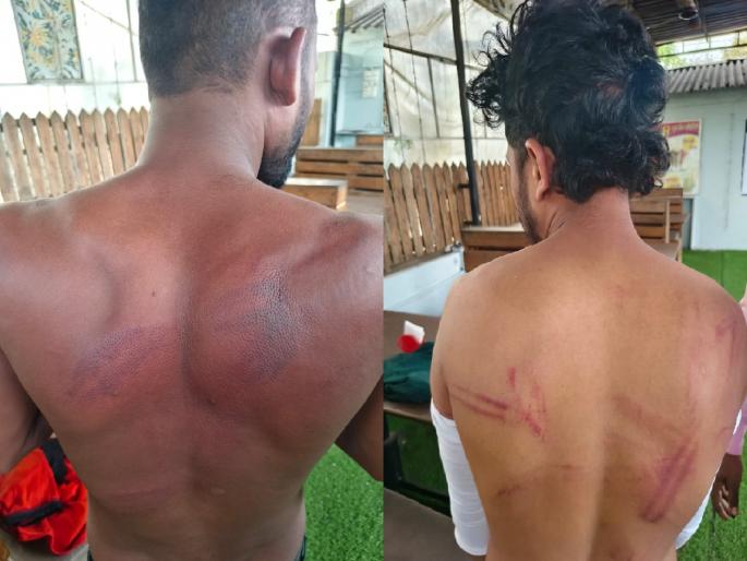 Migrant hotel workers beaten with revolver to their heads in kolhapur | Kolhapur Crime: डोक्याला रिव्हॉल्व्हर लावून परप्रांतीय कामगारांना मारहाण, चौघांविरुद्ध गुन्हा दाखल