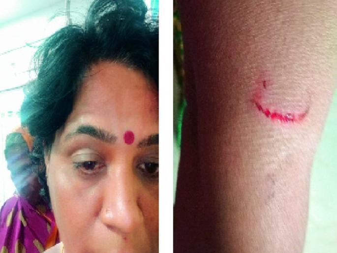 Parent's beats Head Master in Aurangabad | विद्यार्थिनींच्या भांडणातून पालकाची मुख्याध्यापिकेला जबर मारहाण Parent's beats Head Master in Aurangabad | विद्यार्थिनींच्या भांडणातून पालकाची मुख्याध्यापिकेला जबर मारहाण