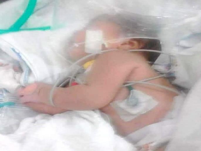 Only three days baby girl fight against scorpion; survives being stung seven times | अवघ्या तीन दिवसांच्या चिमुकलीची अतिजहाल विंचवाशी झुंज; सात वेळा दंश