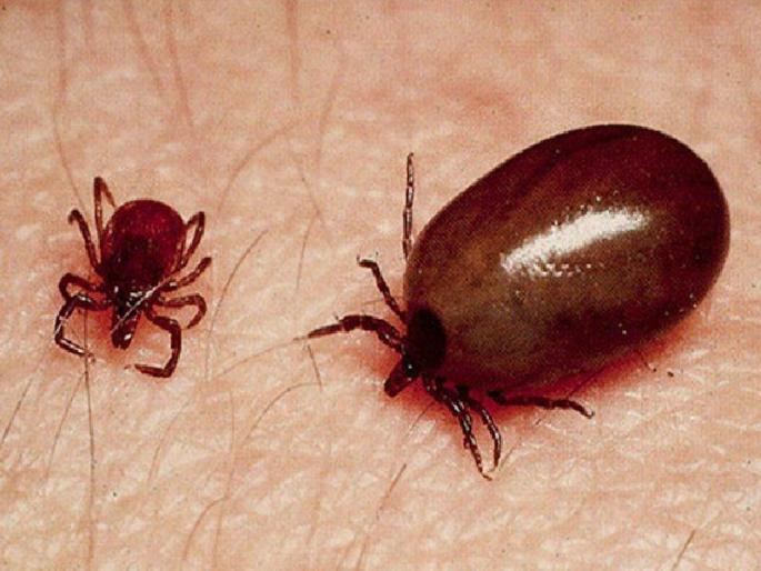 scrub typhus in Kolhapur | कोल्हापुरातील बालकास स्क्रब टायफस, जिल्ह्यातील पहिला रुग्ण scrub typhus in Kolhapur | कोल्हापुरातील बालकास स्क्रब टायफस, जिल्ह्यातील पहिला रुग्ण
