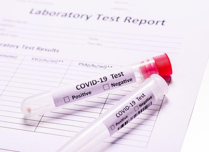 CoronaVirus: 27 more positive in Buldana district | CoronaVirus : बुलडाणा जिल्ह्यात आणखी २७ पॉझिटिव्ह