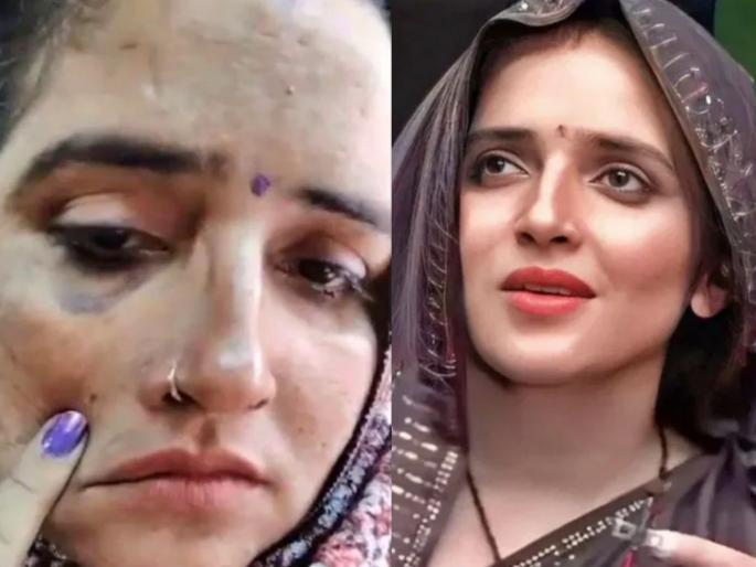 Seema Haider injuries fight with sachin meena assault news truth video viral pakistani media ai fake | Seema Haider : सुजलेले डोळे, चेहऱ्यावर जखमा...; सीमा हैदरने सांगितलं व्हायरल Video मागचं 'सत्य' Seema Haider injuries fight with sachin meena assault news truth video viral pakistani media ai fake | Seema Haider : सुजलेले डोळे, चेहऱ्यावर जखमा...; सीमा हैदरने सांगितलं व्हायरल Video मागचं 'सत्य'
