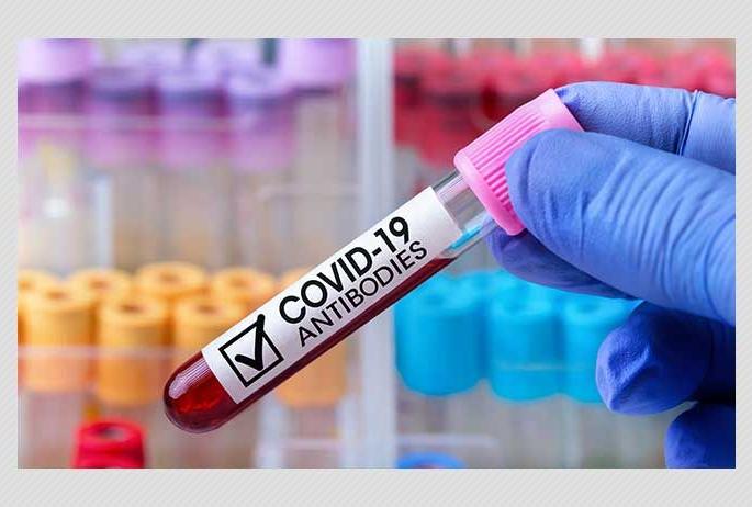 CIRO survey halted in Nagpur due to lack of kits: 2400 people were to be examined | नागपुरात किटअभावी सिरो सर्वेक्षण ठप्प : २४०० लोकांची होणार होती तपासणी CIRO survey halted in Nagpur due to lack of kits: 2400 people were to be examined | नागपुरात किटअभावी सिरो सर्वेक्षण ठप्प : २४०० लोकांची होणार होती तपासणी