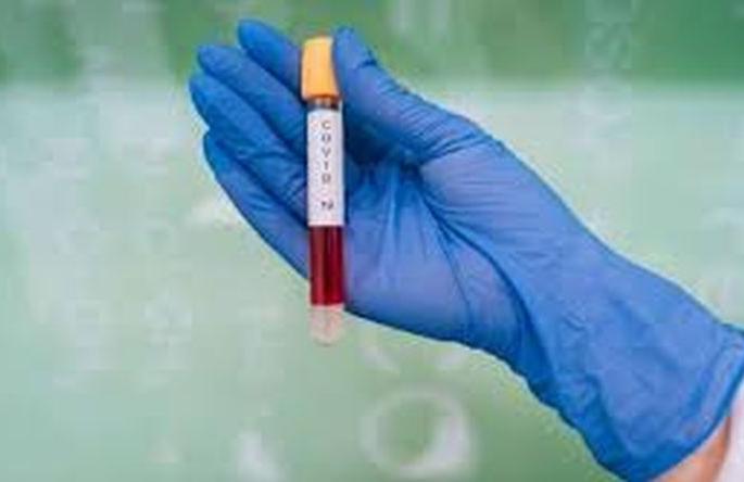 Serological Survey: 15 out of 100 people infected with corona in Akola district! | सेरोलॉजिकल सर्व्हे : अकोला जिल्ह्यात शंभरपैकी १५ व्यक्तींना होऊन गेली कोरोनाची लागण! Serological Survey: 15 out of 100 people infected with corona in Akola district! | सेरोलॉजिकल सर्व्हे : अकोला जिल्ह्यात शंभरपैकी १५ व्यक्तींना होऊन गेली कोरोनाची लागण!
