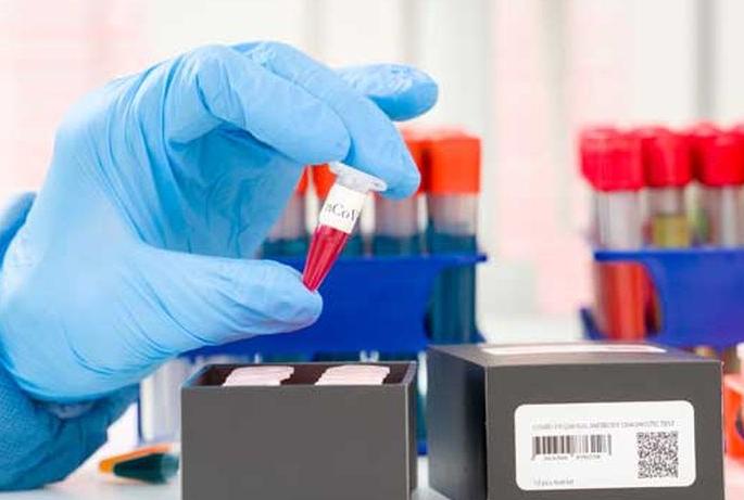 CoronaVirus: 'Sero' survey to be conducted in Akola now! | CoronaVirus : आता अकोल्यातही होणार ‘सेरो’ सर्वेक्षण!