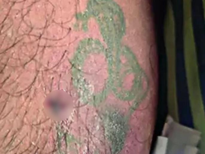 What an unfortunate coincidence! Bhopal man bitten by cobra on ‘Nagin’ tattoo, dies | हा कसला दुर्देवी योगायोग! युवकाच्या ज्या हातावर होता नागाचा टॅटू, त्याचठिकाणी... What an unfortunate coincidence! Bhopal man bitten by cobra on ‘Nagin’ tattoo, dies | हा कसला दुर्देवी योगायोग! युवकाच्या ज्या हातावर होता नागाचा टॅटू, त्याचठिकाणी...