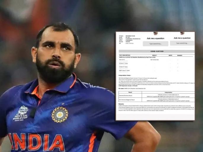 T20 World Cup : Indian bowler Mohammed Shami provides a major update on his Covid situation, shares report on Instagram, to undergo cardiovascular test this week | T20 World Cup : मोहम्मद शमी वर्ल्ड कप खेळणार की नाही? समोर आले मोठे अपडेट्स, BCCI ने घेतला निर्णय