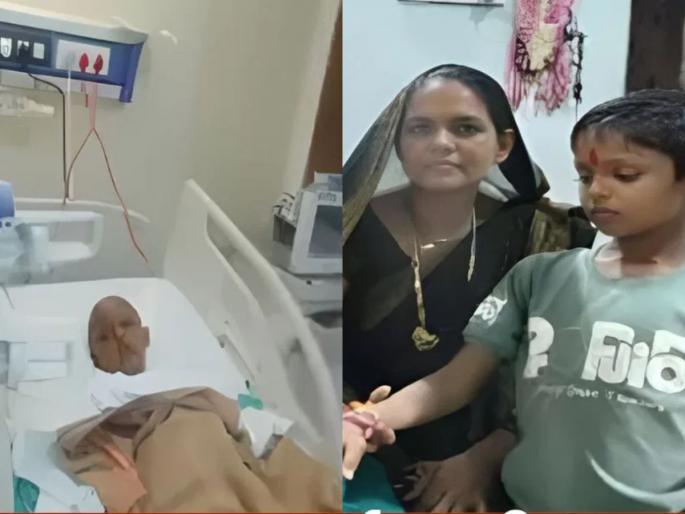 seoni same disease that caused daughter death also affected son mother gifted liver on diwali saving child life | हृदयस्पर्शी! आधी लेक गमावली, मुलालाही झाला तोच आजार; आईने लिव्हर देऊन वाचवला जीव seoni same disease that caused daughter death also affected son mother gifted liver on diwali saving child life | हृदयस्पर्शी! आधी लेक गमावली, मुलालाही झाला तोच आजार; आईने लिव्हर देऊन वाचवला जीव