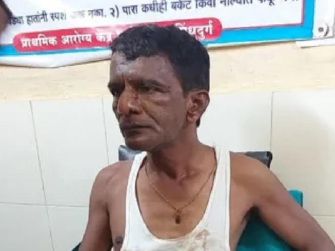 Uddhav Thackeray group worker brutally beaten in Sherpe sindhudurg | Sindhudurg: शेर्पे येथील उद्धवसेनेच्या कार्यकर्त्याला बेदम मारहाण Uddhav Thackeray group worker brutally beaten in Sherpe sindhudurg | Sindhudurg: शेर्पे येथील उद्धवसेनेच्या कार्यकर्त्याला बेदम मारहाण