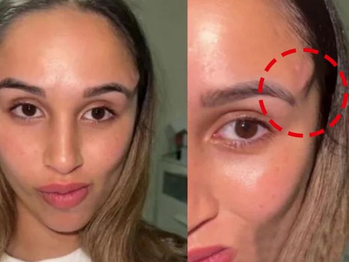 woman got horns on head after cosmetic surgery | सेलिब्रिटींसारखे डोळे हवे म्हणून कॉस्मॅटिक सर्जरी केली, डोक्यावर शिंग उगवली ना राव!