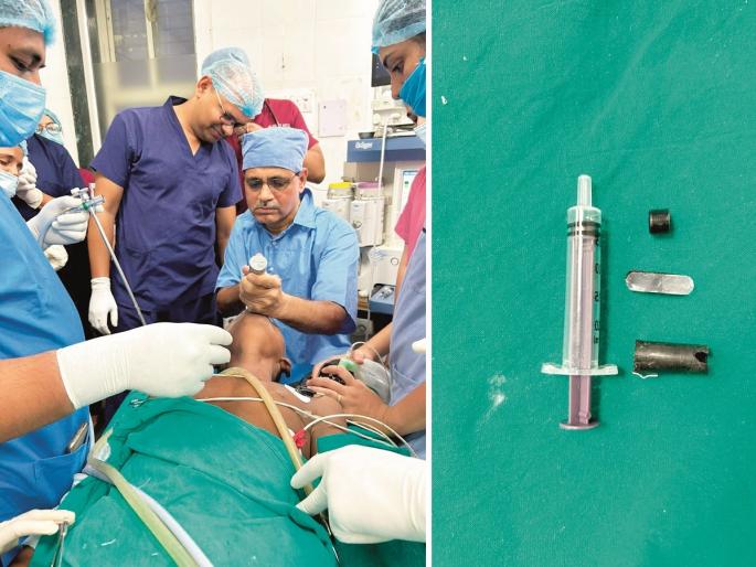 Furrar Furrar! There was mistake while playing, the 14-year-old boy spoke whistled blow | फुर्रर फुर्रर! खेळतानाची चुक नडली, १४ वर्षीय मुलगा बोलला की वाजायची शिट्टीच Furrar Furrar! There was mistake while playing, the 14-year-old boy spoke whistled blow | फुर्रर फुर्रर! खेळतानाची चुक नडली, १४ वर्षीय मुलगा बोलला की वाजायची शिट्टीच