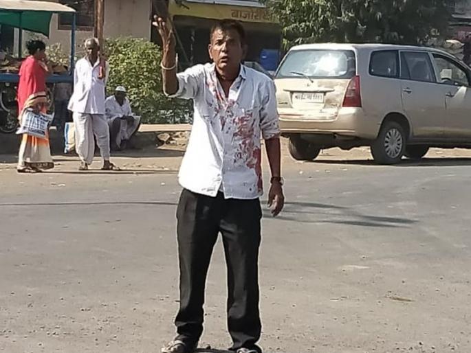 Shiv Sena activist injured himself by hitting blade | शिवसेनेचे सरकार स्थापन होत नसल्याने उद्विग्न शिवसैनिकाने स्वत:लाच ‘ब्लेड’ मारून केले जखमी Shiv Sena activist injured himself by hitting blade | शिवसेनेचे सरकार स्थापन होत नसल्याने उद्विग्न शिवसैनिकाने स्वत:लाच ‘ब्लेड’ मारून केले जखमी