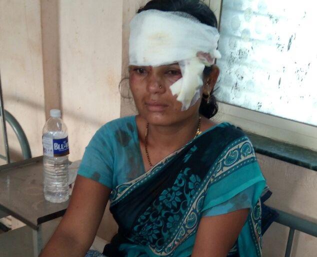 Smugglers in Shrongonda taluka; Suicide Three | श्रीगोंदा तालुक्यात दरोडेखोरांचा धुमाकूळ; तिघांना जबर मारहाण