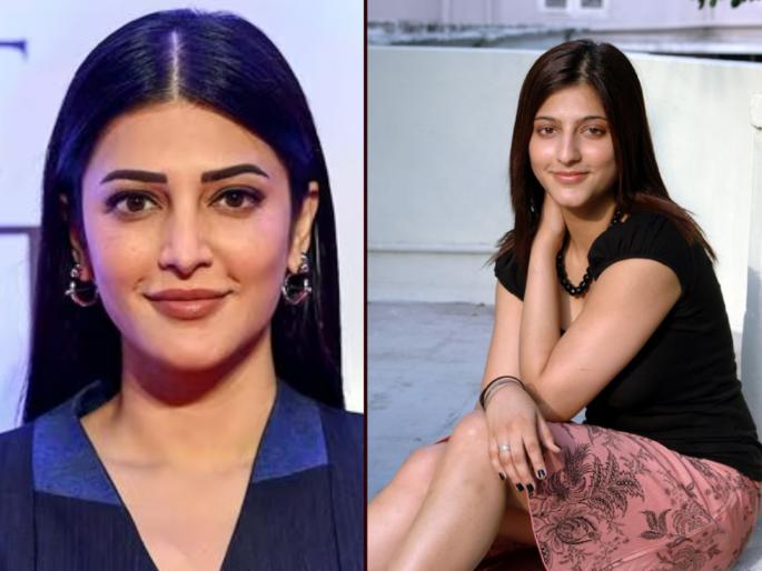 shruti haasan blunt reply to trollers calling her plastic surgery ki dukaan actress starring in coolie | प्लास्टिक सर्जरीची दुकान म्हणणाऱ्यांना श्रुती हासनचं सडेतोड उत्तर; म्हणाली, "किंमत चुकवावी..."