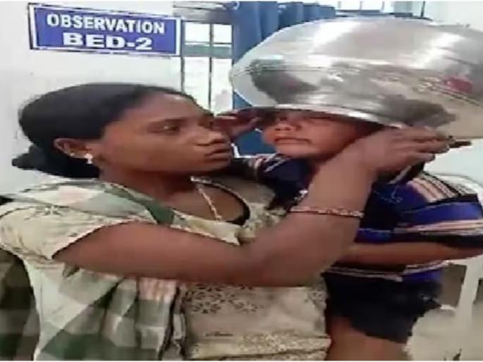 4 year old head stuck in steel utensil doctors perform save his life | अरे बापरे! खेळता खेळता ४ वर्षांच्या मुलासोबत आक्रित घडलं, स्टीलचं भांडं डोक्यात अडकलं 4 year old head stuck in steel utensil doctors perform save his life | अरे बापरे! खेळता खेळता ४ वर्षांच्या मुलासोबत आक्रित घडलं, स्टीलचं भांडं डोक्यात अडकलं