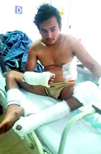 Wounds on all body Shubham's dream of becoming a policeman in the eyes | सर्वांगावर जखमा झालेल्या शुभमच्या डोळ्यात पोलीस होण्याचे स्वप्न