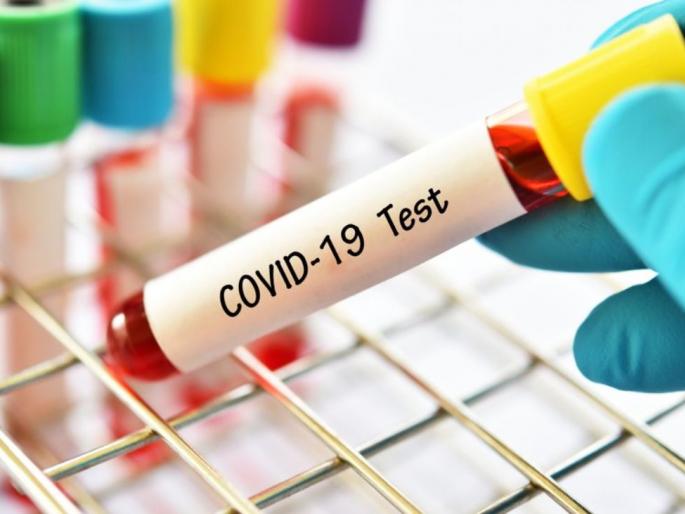 The coroner's test report was pending and the head of the laboratory was removed | शासकीय रूग्णालयातील प्रयोगशाळा प्रमुखांचा पदभार काढला; जाणून घ्या...काय आहे कारण The coroner's test report was pending and the head of the laboratory was removed | शासकीय रूग्णालयातील प्रयोगशाळा प्रमुखांचा पदभार काढला; जाणून घ्या...काय आहे कारण