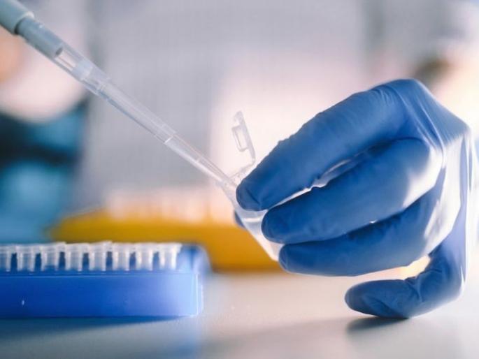 corona enters in Chandrapur, one positive | आतापर्यंत ऑरेंज झोनमध्ये असलेल्या चंद्रपुरात कोरोनाचा शिरकाव corona enters in Chandrapur, one positive | आतापर्यंत ऑरेंज झोनमध्ये असलेल्या चंद्रपुरात कोरोनाचा शिरकाव