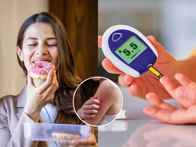 5 Signs That You Have Too Much Sugar In Your Body | तुमच्या शरीरातली साखर वाढली आहे हे सांगणारी ५ लक्षणं, मधुमेह टाळायचा तर वेळीच सतर्क व्हा 5 Signs That You Have Too Much Sugar In Your Body | तुमच्या शरीरातली साखर वाढली आहे हे सांगणारी ५ लक्षणं, मधुमेह टाळायचा तर वेळीच सतर्क व्हा