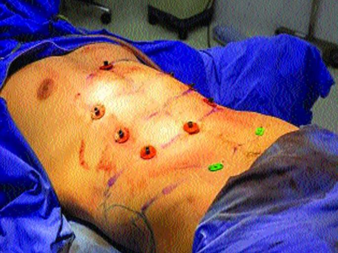  Six-Pack in just hour | काही तासांमध्येच बनवून मिळतात Six-Pack!