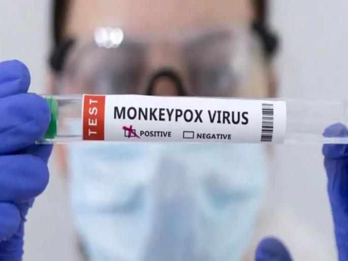 Monkeypox: UP govt issues alert on Monkeypox; 'These' people need to live in isolation | Monkeypox: 'मंकीपॉक्स'बाबत UP सरकारचा अलर्ट; 'या' लोकांना आयसोलेशनमध्ये राहण्याचे आदेश Monkeypox: UP govt issues alert on Monkeypox; 'These' people need to live in isolation | Monkeypox: 'मंकीपॉक्स'बाबत UP सरकारचा अलर्ट; 'या' लोकांना आयसोलेशनमध्ये राहण्याचे आदेश