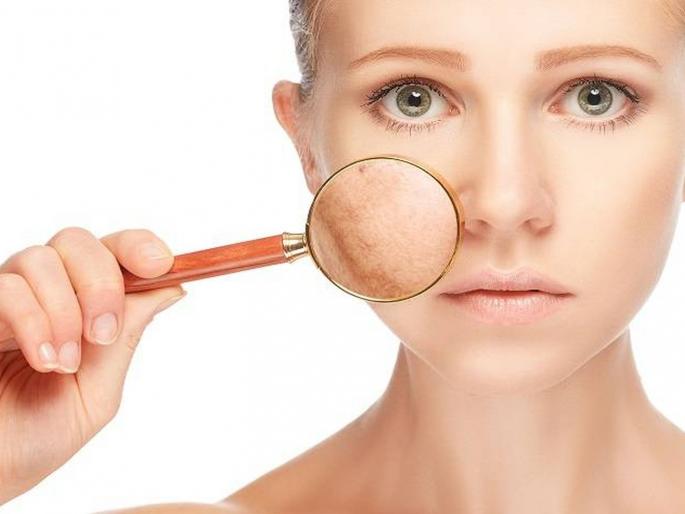 5 home remedies for attractive skin in winter | हे' 5 घरगुती उपाय करुनही मिळवू शकता हिवाळ्यात आकर्षक त्वचा 5 home remedies for attractive skin in winter | हे' 5 घरगुती उपाय करुनही मिळवू शकता हिवाळ्यात आकर्षक त्वचा