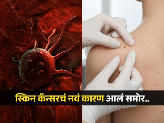 Skin Cancer : Researchers finds beta hpv virus can directly cause skin cancer | व्हायरसमुळे होतोय स्किन कॅन्सर, संशोधकांचा दावा; व्हायरल इन्फेक्शनमुळे समजला कॅन्सरचा धोका
