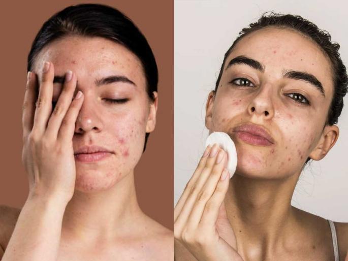 Kids and tweens are developing lifelong issues because of their skin care routines, warns derm — the No. 1 culprit | टीनएजर्ससाठी अलर्ट! सुंदर दिसण्याची हौस भलतीच महागात; 'स्किनकेअर'ची क्रेझ धोकादायक