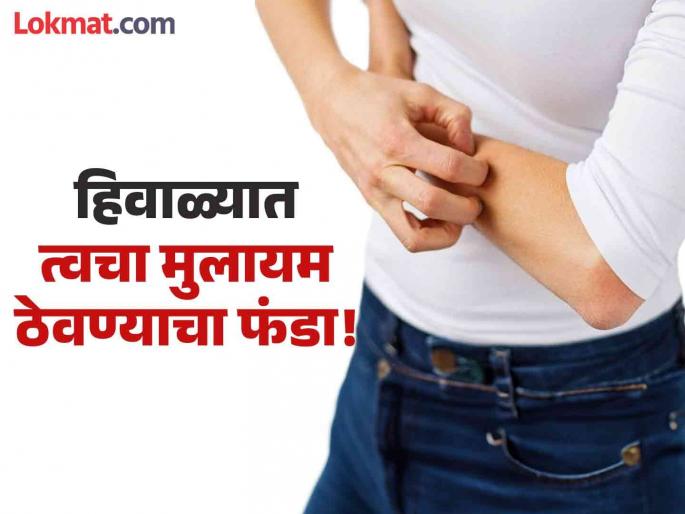 Home remedies to get relief from itching in Winter | थंडीच्या दिवसात त्वचेवरील खाज दूर करण्याचे सोपे घरगुती उपाय, त्वचा होईल मुलायम! Home remedies to get relief from itching in Winter | थंडीच्या दिवसात त्वचेवरील खाज दूर करण्याचे सोपे घरगुती उपाय, त्वचा होईल मुलायम!