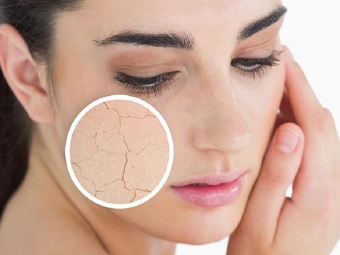 The most common skin problem in winter is dry skin | सीवम निर्मिती घटल्याने हिवाळ्यात त्वचा रुक्ष!, 'अशी' घ्या त्वचेची काळजी The most common skin problem in winter is dry skin | सीवम निर्मिती घटल्याने हिवाळ्यात त्वचा रुक्ष!, 'अशी' घ्या त्वचेची काळजी