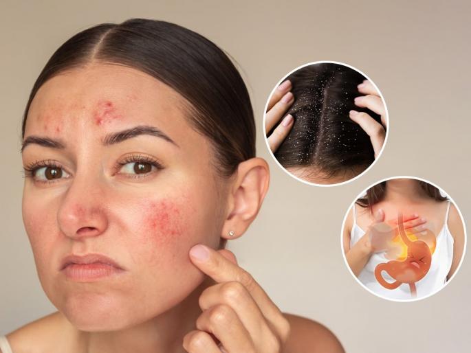 Do you get pimples on your face? You may not know these 2 main reasons, see what goes wrong | चेहर्‍यावर सारखे पिंपल्स येतात? ही २ मुख्य कारणे माहितीच नसतील, पाहा काय चुकते