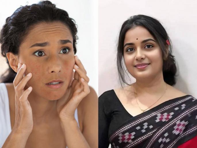 October heat: Skin darkened by the sun will become beautiful, try these home remedies | October heat : उन्हामुळे काळवंडलेली त्वचा होईल सुंदर, करा हे घरगुती उपाय