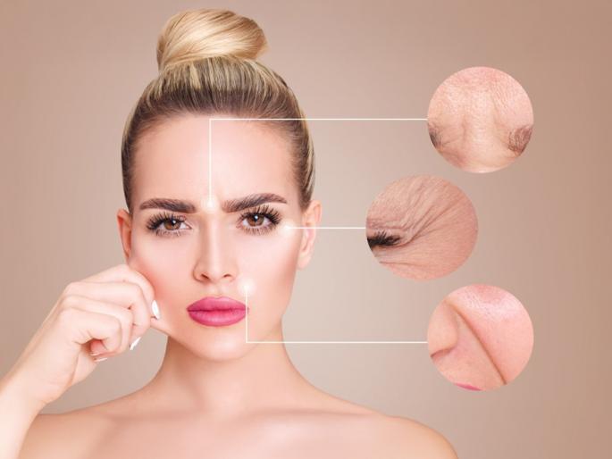 Poppy seeds for glowing skin Home remedy for acne and pigmentation Natural face pack Remove dark spots with kitchen ingredients | स्वयंपाकघरातील ‘हे’ खास इटुकले दाणे चेहऱ्यावर करतात जादू! मुरुम-पिग्मेंटेशनचे डाग काहीच दिवसात गायब