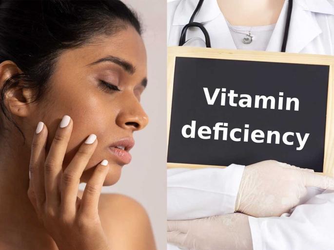 What deficiency causes dark circles under eyes Why my face looks dull and pigmented Iron and B12 deficiency effects on skin | डोळ्यांखाली काळी वर्तुळे, चेहरा काळपट? शरीरात १ गोष्टीची कमतरता, हरवते त्वचेचं सौंदर्य- दिसता वयाआधी म्हातारे..