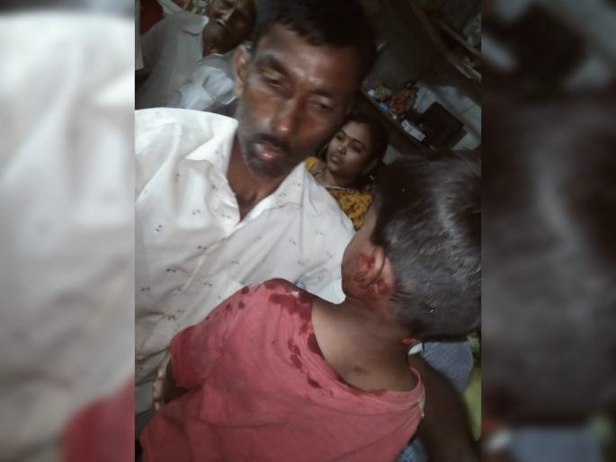 The father confronted the leopard that was attacking the child; Thrilling events in Karad | मुलावर हल्ला करणाऱ्या बिबट्याशी बाप भिडला; कऱ्हाडमधील थरारक घटना The father confronted the leopard that was attacking the child; Thrilling events in Karad | मुलावर हल्ला करणाऱ्या बिबट्याशी बाप भिडला; कऱ्हाडमधील थरारक घटना
