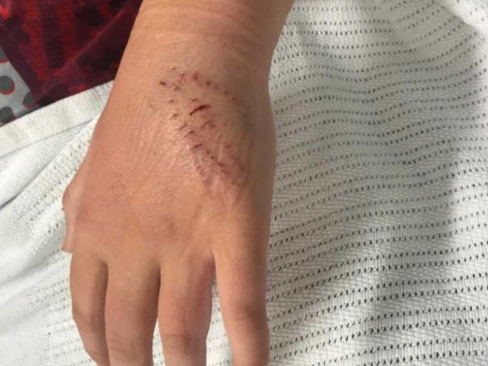 Young man dies of snake bite at Ombal | ओंबळ येथील युवकाचा सर्पदंशाने मृत्यू Young man dies of snake bite at Ombal | ओंबळ येथील युवकाचा सर्पदंशाने मृत्यू