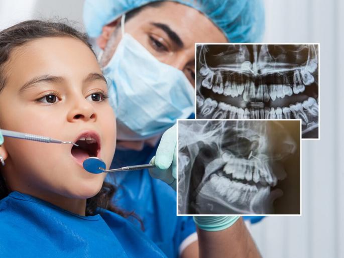 Doctor found something unusual while scanning little girl's X-ray, something strange | करायला गेली एक आणि..! १३ वर्षांच्या मुलीच्या एक्स-रेत निघालं भलतंच काहीतरी-आईबाबा हतबल