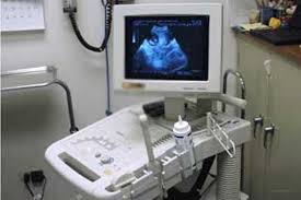 Now Sonography facilities are available at Mangarlapir Rural Hospital | मंगरुळपीर ग्रामीण रुग्णालयात आता सोनोग्राफीची सुविधा 