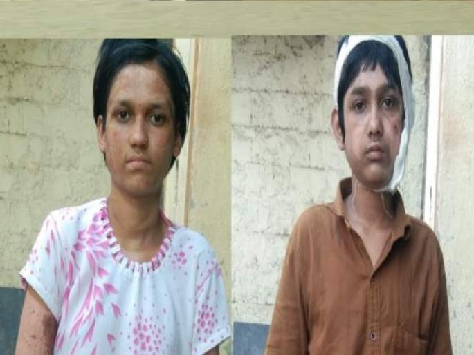 Sonsal two siblings who became destitute due to the death of their parents in a cylinder blast will get maintenance allowance government jobs | सोनसळमधील दोघा भावंडांना मिळणार संगोपन भत्ता, शासकीय नोकरी; सिलिंडरच्या स्फोटामुळे बनले होते निराधार Sonsal two siblings who became destitute due to the death of their parents in a cylinder blast will get maintenance allowance government jobs | सोनसळमधील दोघा भावंडांना मिळणार संगोपन भत्ता, शासकीय नोकरी; सिलिंडरच्या स्फोटामुळे बनले होते निराधार