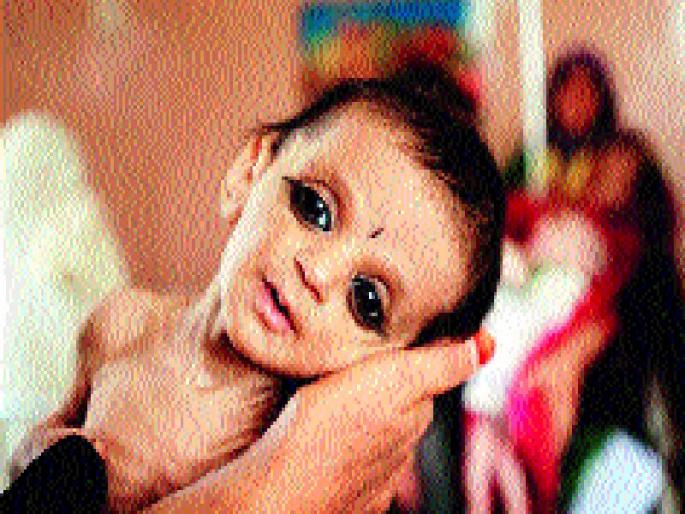 Low-weight children in Baramati | बारामती तालुक्यात कमी वजनाची बालके Low-weight children in Baramati | बारामती तालुक्यात कमी वजनाची बालके