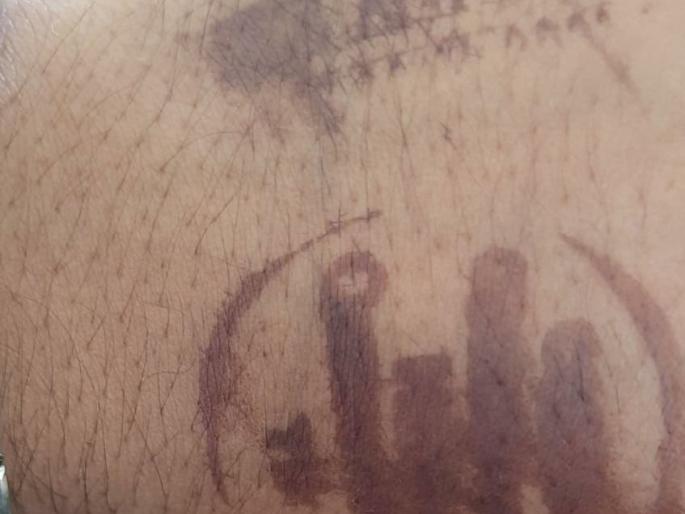 Travel in August, Home Quarantine stamps of April | ऑगस्टमध्ये प्रवास, होम क्वारंटाईनचे शिक्के एप्रिलचे Travel in August, Home Quarantine stamps of April | ऑगस्टमध्ये प्रवास, होम क्वारंटाईनचे शिक्के एप्रिलचे