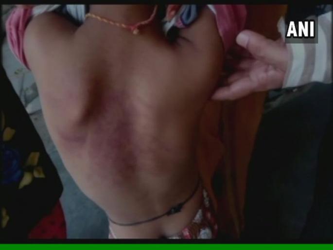 In the absence of reading the word on the boards, the other student's inhuman beat of the principal | फळ्यावरील शब्द वाचता न आल्याने दुसरीतील विद्यार्थ्याला मुख्याध्यापकाची अमानुष मारहाण In the absence of reading the word on the boards, the other student's inhuman beat of the principal | फळ्यावरील शब्द वाचता न आल्याने दुसरीतील विद्यार्थ्याला मुख्याध्यापकाची अमानुष मारहाण