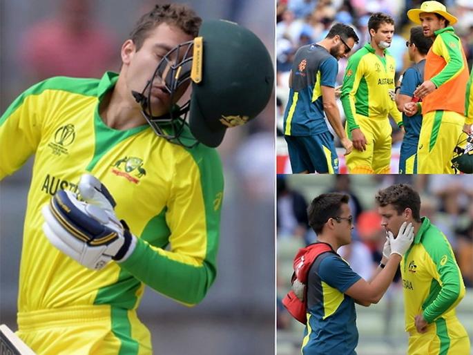 If the players are injured during the match, the substitute will bat - bowling? | मॅच दरम्यान खेळाडू जखमी झाल्यास सबस्टिट्यूट करणार फलंदाजी - गोलंदाजी?