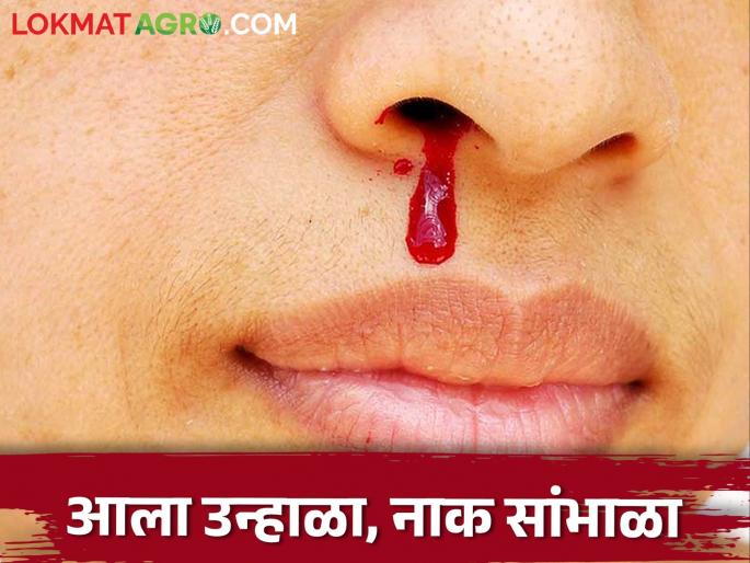 climate is very hot, blood can come from the nose.. Don't panic, do it | उन्ह खुप वाढलंय नाकातून येऊ शकतं रक्त.. घाबरू नका, हे करा climate is very hot, blood can come from the nose.. Don't panic, do it | उन्ह खुप वाढलंय नाकातून येऊ शकतं रक्त.. घाबरू नका, हे करा
