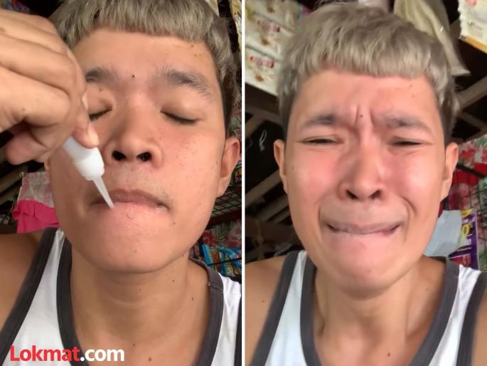 How to remove glue from body apply superglue on lips viral video | VIDEO : मस्तीच्या नादात मुलानं चिकटवून घेतले ओठ, सुपरग्लू बनला त्याच्यासाठी मोठी समस्या! How to remove glue from body apply superglue on lips viral video | VIDEO : मस्तीच्या नादात मुलानं चिकटवून घेतले ओठ, सुपरग्लू बनला त्याच्यासाठी मोठी समस्या!