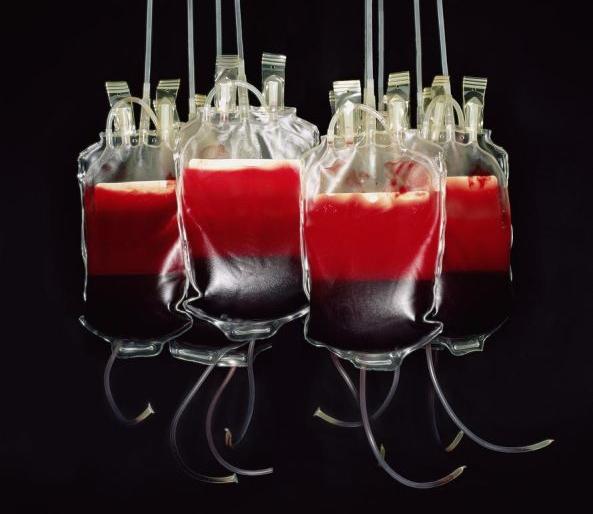 Now there is a shortage of blood bags; How to treat dengue patients in Nagpur | आता रक्त पिशव्यांचा तुटवडा; कसा होणार नागपुरातील डेंग्यू रुग्णांवर उपचार?